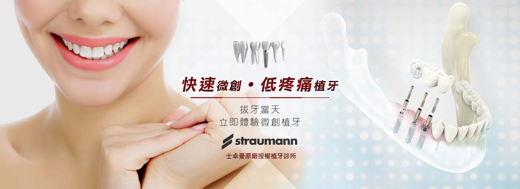 快速微創 . 低疼痛植牙