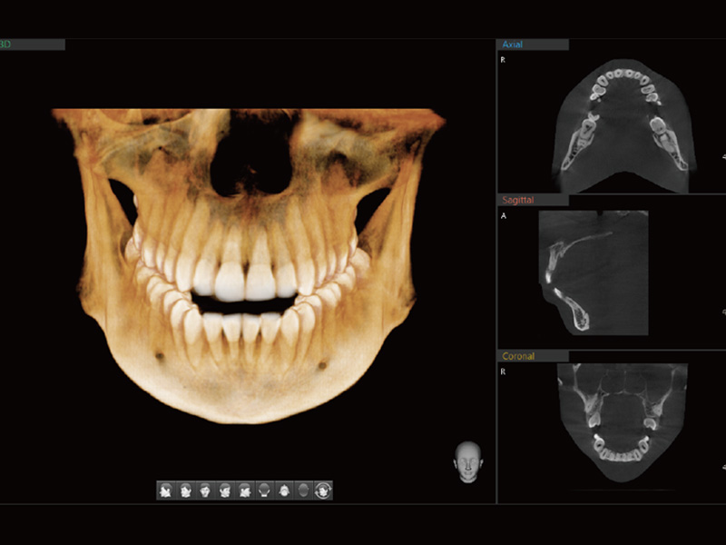 高階3D電腦斷層掃描