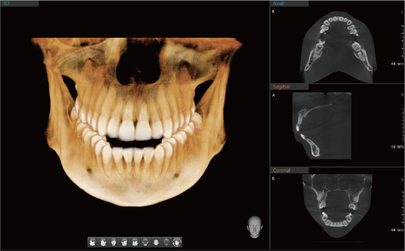 高階3D電腦斷層掃描