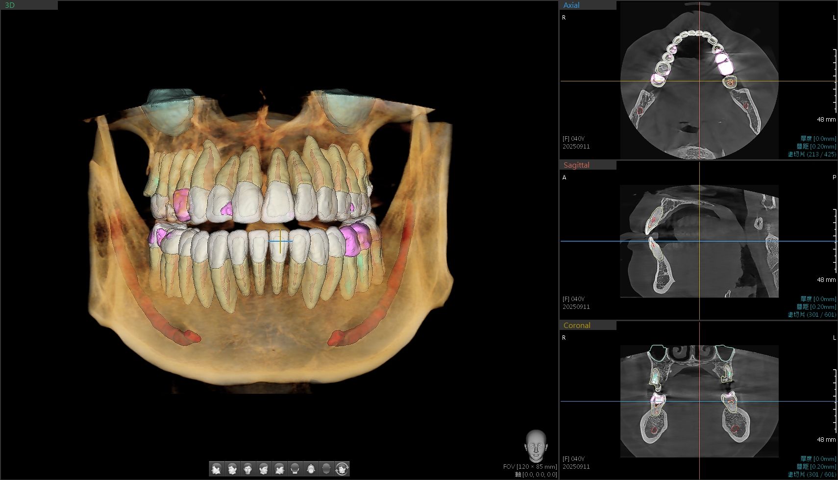 ✨ 診所再升級！全口 AI 3D 彩色影像正式上線 ✨