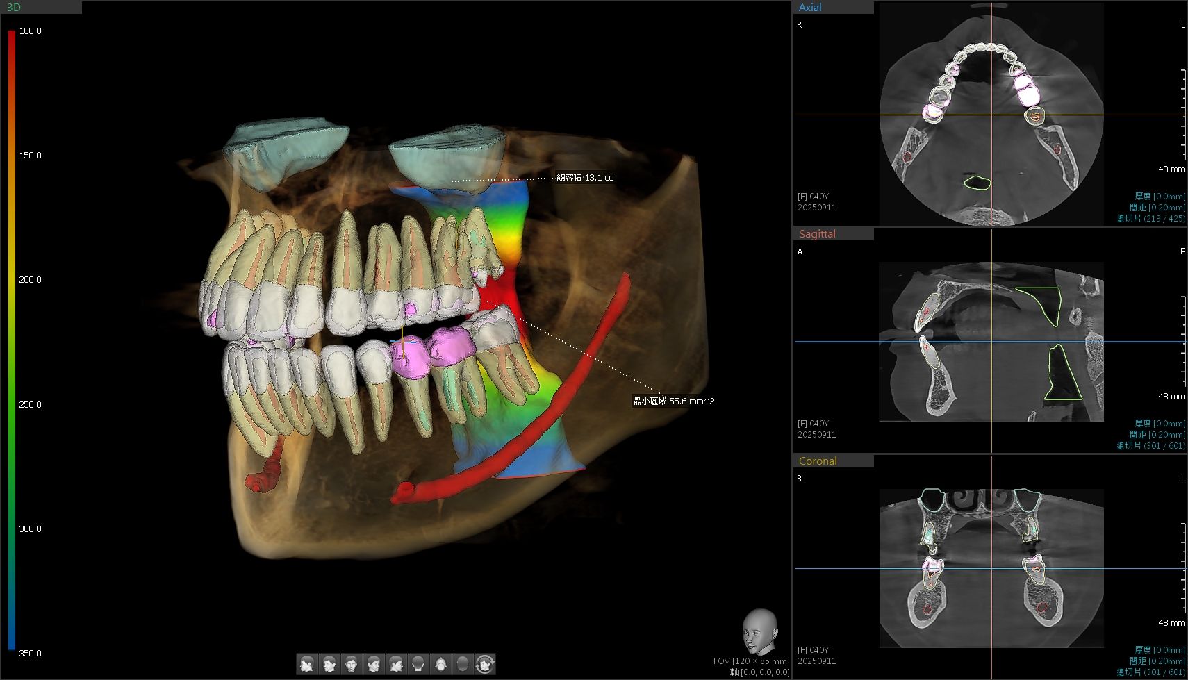 ✨ 診所再升級！全口 AI 3D 彩色影像正式上線 ✨